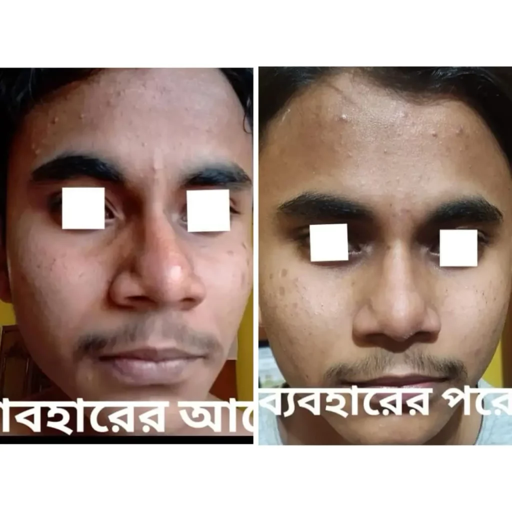 WhatsApp-Image-2024-02-04-at-1.12.38-PM-1024x1024-1.webp